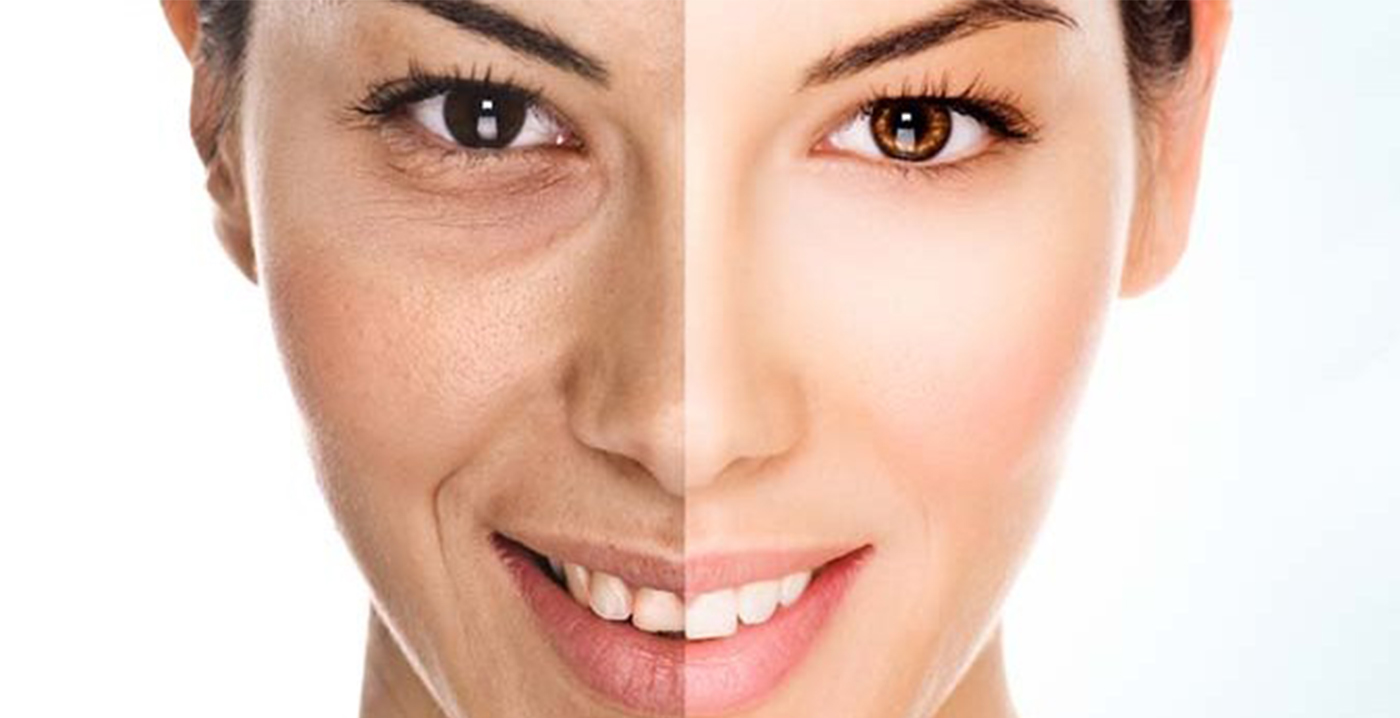 Anti-Aging & Healthy Aging in Turkey