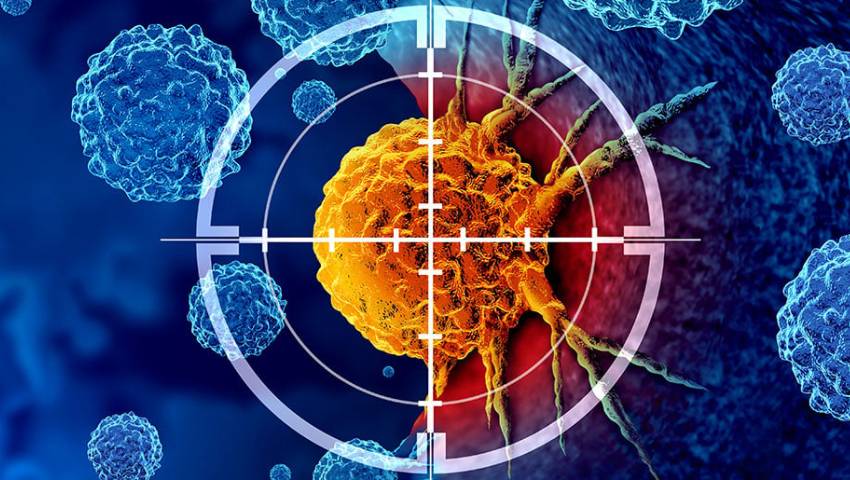 Cancer Treatment in Turkey